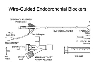 Wire-Guided Endobronchial Blockers
 