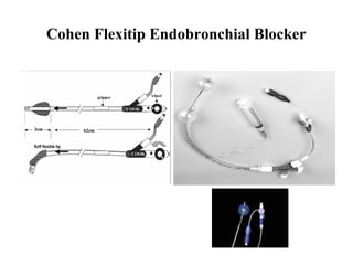 Cohen Flexitip Endobronchial Blocker
 