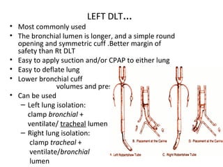 LEFT DLT…
• Most commonly used
• The bronchial lumen is longer, and a simple round
opening and symmetric cuff .Better margin of
safety than Rt DLT
• Easy to apply suction and/or CPAP to either lung
• Easy to deflate lung
• Lower bronchial cuff
volumes and pressures
• Can be used
– Left lung isolation:
clamp bronchial +
ventilate/ tracheal lumen
– Right lung isolation:
clamp tracheal +
ventilate/bronchial
lumen
 