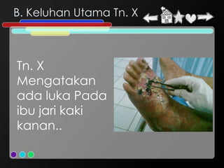 B. Keluhan Utama Tn. X



Tn. X
Mengatakan
ada luka Pada
ibu jari kaki
kanan..
 