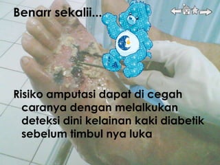 Benarr sekalii....




Risiko amputasi dapat di cegah
  caranya dengan melalkukan
  deteksi dini kelainan kaki diabetik
  sebelum timbul nya luka
 