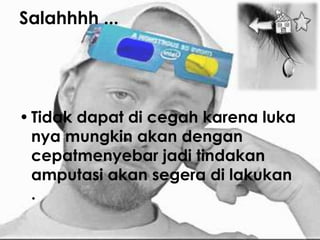 Salahhhh ...




• Tidak dapat di cegah karena luka
  nya mungkin akan dengan
  cepatmenyebar jadi tindakan
  amputasi akan segera di lakukan
  .
 