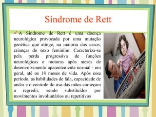 Síndrome de Rett 
 A Síndrome de Rett é uma doença 
neurológica provocada por uma mutação 
genética que atinge, na maioria dos casos, 
crianças do sexo feminino. Caracteriza-se 
pela perda progressiva de funções 
neurológicas e motoras após meses de 
desenvolvimento aparentemente normal - em 
geral, até os 18 meses de vida. Após esse 
período, as habilidades de fala, capacidade de 
andar e o controle do uso das mãos começam 
a regredir, sendo substituídos por 
movimentos involuntários ou repetitivos 
 