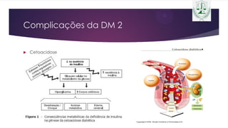Complicações da DM 2
 Cetoacidose
 