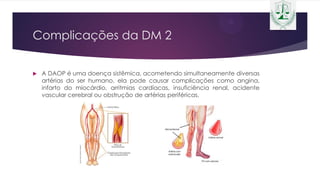 Complicações da DM 2
 A DAOP é uma doença sistêmica, acometendo simultaneamente diversas
artérias do ser humano, ela pode causar complicações como angina,
infarto do miocárdio, arritmias cardíacas, insuficiência renal, acidente
vascular cerebral ou obstrução de artérias periféricas.
 