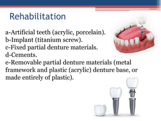 Rehabilitation
a-Artificial teeth (acrylic, porcelain).
b-Implant (titanium screw).
c-Fixed partial denture materials.
d-Cements.
e-Removable partial denture materials (metal
framework and plastic (acrylic) denture base, or
made entirely of plastic).
 