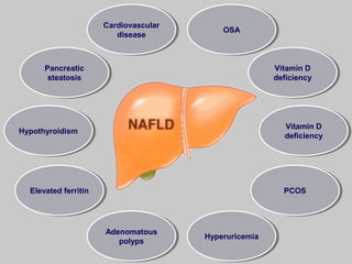 Cardiovascular
disease
Cardiovascular
disease
OSAOSA
Vitamin D
deficiency
Vitamin D
deficiency
Vitamin D
deficiency
Vitamin D
deficiency
PCOSPCOS
HyperuricemiaHyperuricemia
Adenomatous
polyps
Adenomatous
polyps
Elevated ferritinElevated ferritin
HypothyroidismHypothyroidism
Pancreatic
steatosis
Pancreatic
steatosis
 