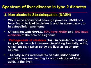 Spectrum of liver disease in type 2 diabetesSpectrum of liver disease in type 2 diabetes
3. Non alcoholic Steatohepatitis (NASH)
• While once considered a benign process, NASH has
been found to lead to cirrhosis and, in some cases, to
hepatocellular carcinoma.
• Of patients with NAFLD, 50% have NASH50% have NASH and 19% have19% have
cirrhosiscirrhosis at the time of diagnosis.
• Pathogenesis of steatosis :Insulin resistance resulting
in lipolysis, which increases circulating free fatty acids,
which are then taken up by the liver as an energy
source.
• The fatty acids overload the hepatic mitochondrial
oxidation system, leading to accumulation of fatty
acids in the liver.
Marchesini G, et al: Nonalcoholic fatty liver, steatohepatitis, and the metabolic syndrome. Hepatology 37:917–923, 2003
 