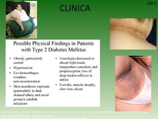 CLINICA DM 2 http://dermatology.cdlib.org/DOJvol6num1/original/acanthosis/katz.html Emedicine.com:  Diabetes Mellitus, Type 2.  Aug 6, 2008.  Kenneth Patrick L Ligaray, MD, Fellow, Department of Endocrinology, Diabetes and Metabolism, St Louis University 