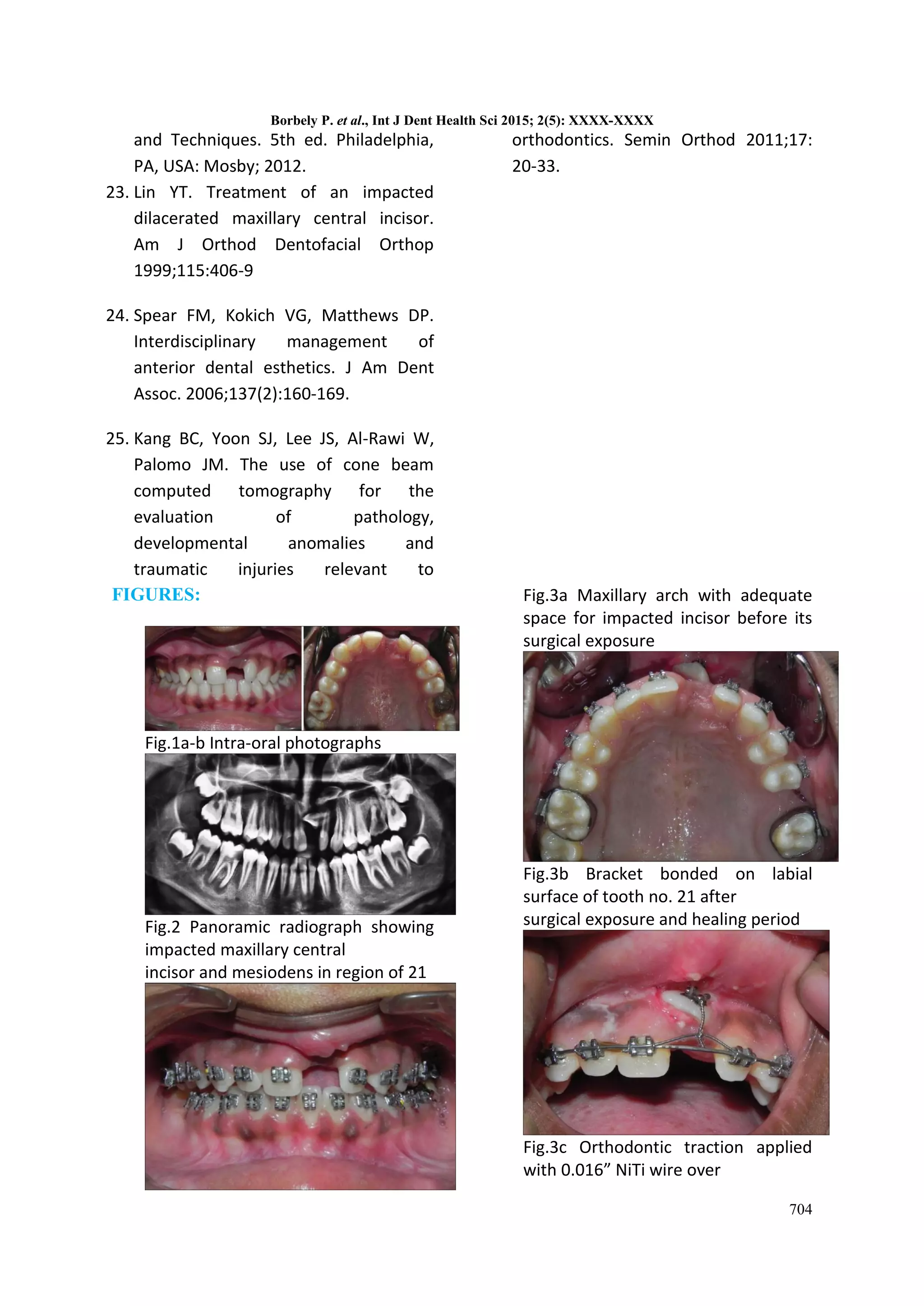 ORTHODONTIC TREATMENT OF AN IMPACTED MAXILLARY CENTRAL INCISOR COMBINED ...