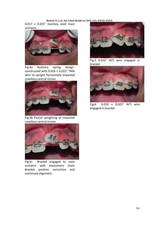 ORTHODONTIC TREATMENT OF AN IMPACTED MAXILLARY CENTRAL INCISOR COMBINED ...