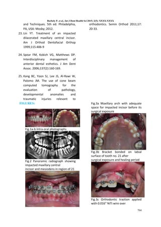 ORTHODONTIC TREATMENT OF AN IMPACTED MAXILLARY CENTRAL INCISOR COMBINED ...