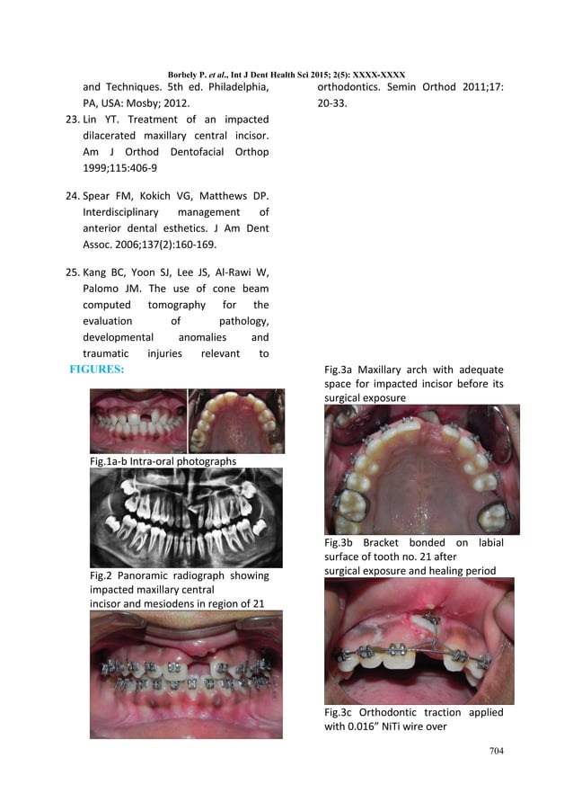 ORTHODONTIC TREATMENT OF AN IMPACTED MAXILLARY CENTRAL INCISOR COMBINED