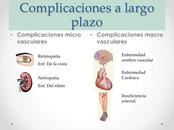 Diabetes Mellitus II Diabetes Mellitus II