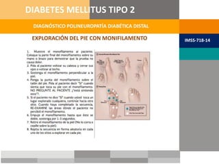 EXPLORACIÓN DEL PIE CON MONIFILAMENTO
DIAGNÓSTICO POLINEUROPATÍA DIABÉTICA DISTAL
DIABETES MELLITUS TIPO 2
IMSS-718-14
 