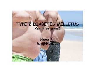 TYPE 2 DIABETES MELLITUS
Can it be cured?
Hanno Pijl
h.pijl@lumc.nl
 