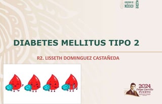 DIABETES MELLITUS TIPO 2
R2. LISSETH DOMINGUEZ CASTAÑEDA
 