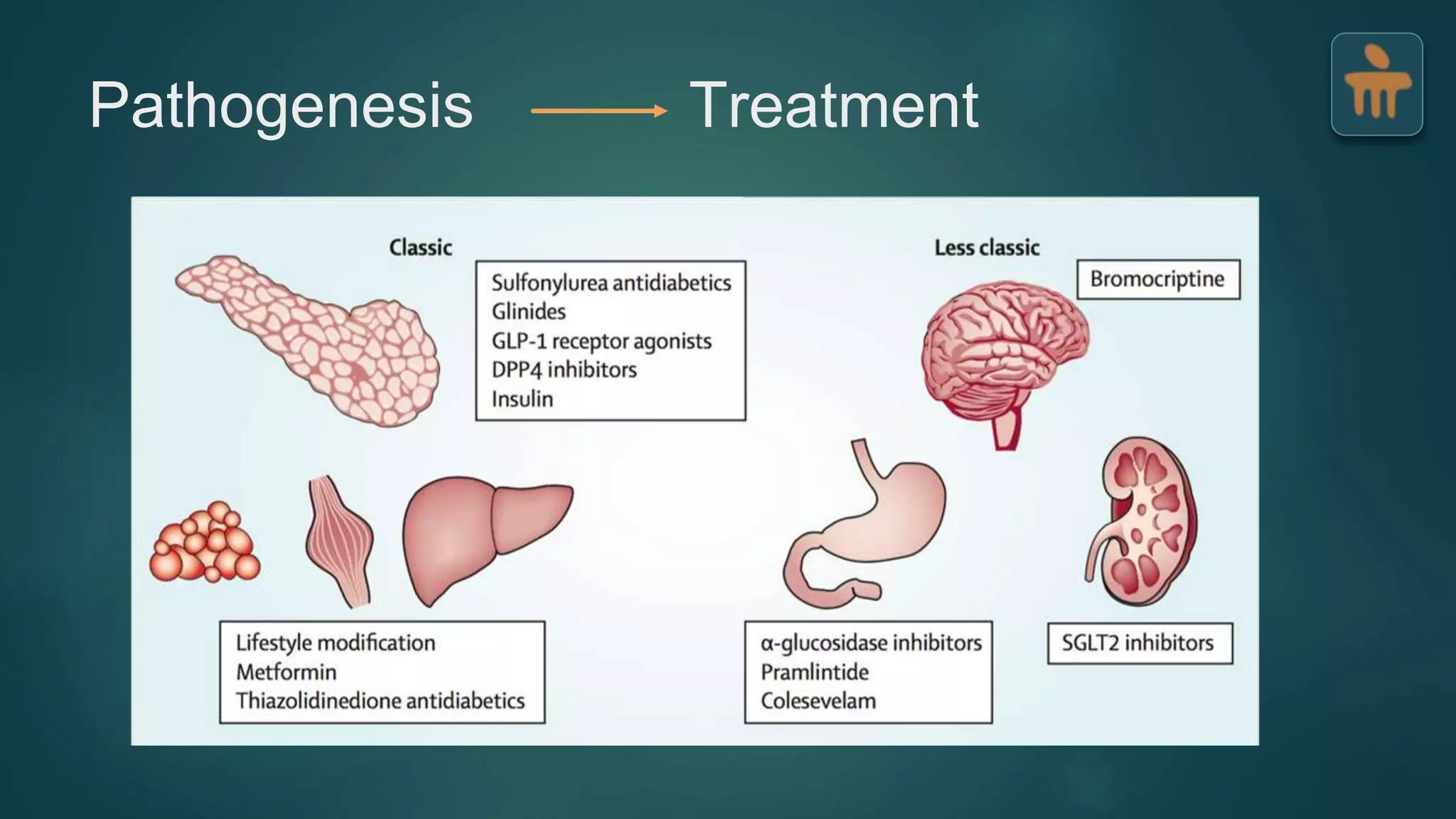 Type 2 Diabetes Mellitus - Pathophysiology | PPTX