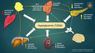 peripheral
glucose
uptake
hepatic
glucose
production
pancreatic
insulin
secretion
pancreatic
glucagon
secretion
Gut
carbohydrate
delivery &
absorption
incretin
effect
Defronzo RA. Diabetes. 2009 Apr;58(4):773-95
Inzucchi SE, Sherwin RS in: Cecil Medicine 2011
renal
glucose
excretion
Hyperglycemia (T2DM)
 