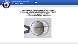 INYECCION DE UN ESPERMATOZOIDE DENTRO
OVULO. SE OBSERVA EL PRIMER CUERPO POLAR.
El primer cuerpo polar se utiliza
En el diagnóstico de pre fecundación
 