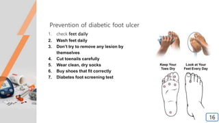 Prevention of diabetic foot ulcer
1. check feet daily
2. Wash feet daily
3. Don’t try to remove any lesion by
themselves
4. Cut toenails carefully
5. Wear clean, dry socks
6. Buy shoes that fit correctly
7. Diabetes foot screening test
16
 