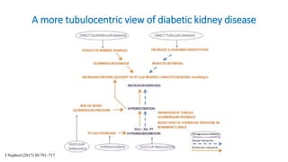 A more tubulocentric view of diabetic kidney disease
J Nephrol (2017) 30:701–717
 