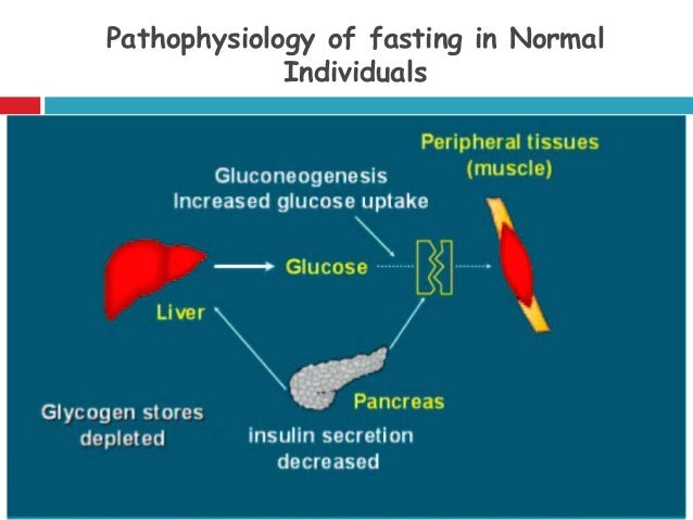 Diabetes Mellitus and Fasting Ramadan may 2015