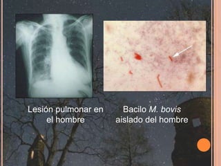 Métodos indirectosPrueba Tuberculinica Cervical Simple: medir la reacción inmunitaria tras la inyección intradérmica de una pequeña cantidad de antígeno. Prueba Tuberculinica Ano-Caudal: esta prueba se realiza en el pliegue ano-caudal interno a unos 6 cm. de la base de la cola y en el en el tercio medio del pliegue ano-caudal interno. Esta zona es menos sensible a la tuberculina que la piel del cuelloPrueba tuberculínica comparativa: la prueba intradérmica comparativa se utiliza para la realización de un diagnostico diferencial entre animales infectados por Mycobacteriumbovis y aquellos sensibilizados a la tuberculina por exposición a otras micobacterias. Esta prueba consiste en la inyección de tuberculina bovina y tuberculina aviar, previa limpieza con un producto no irritante, en diferentes puntos del cuello y en la subsiguiente evaluación de la respuesta transcurridas 72 horas