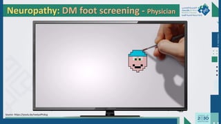 Dr.
Majdi
AlJasim
Neuropathy: DM foot screening - Physician
Source: https://youtu.be/vwIyulPnXcg
 