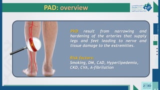Dr.
Majdi
AlJasim
PAD: overview
PVD result from narrowing and
hardening of the arteries that supply
legs and feet leading to nerve and
tissue damage to the extremities.
Risk factors:
Smoking, DM, CAD, Hyperlipedemia,
CKD, CVA, A-fibrilation
 