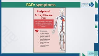 Dr.
Majdi
AlJasim
PAD: symptoms
 