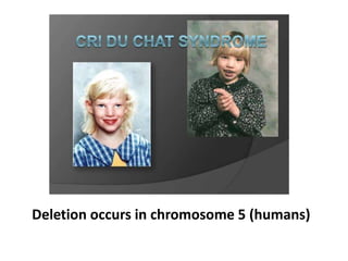 Deletion occurs in chromosome 5 (humans)
 