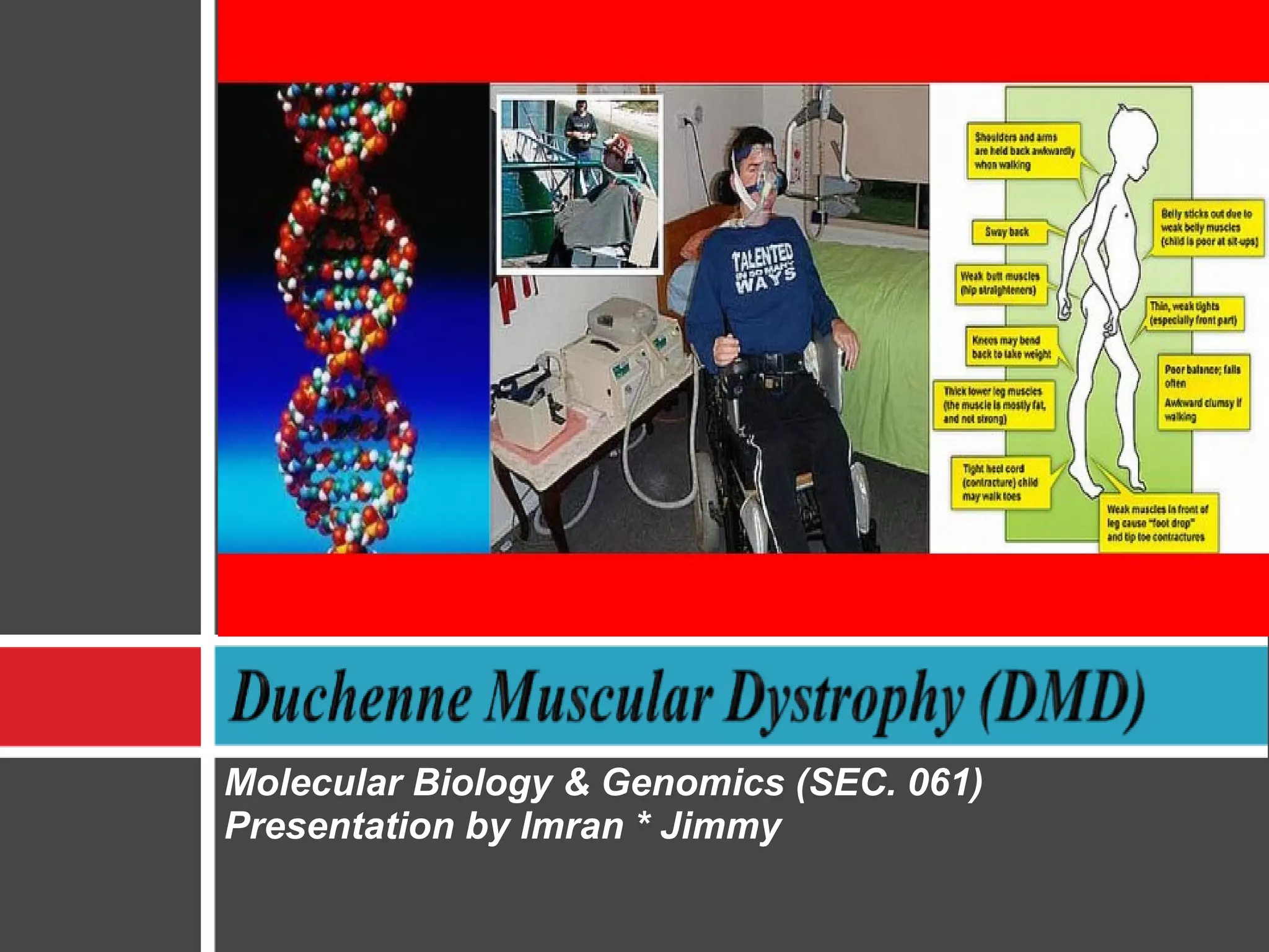 Duchenne Muscular Distrophy | PPT