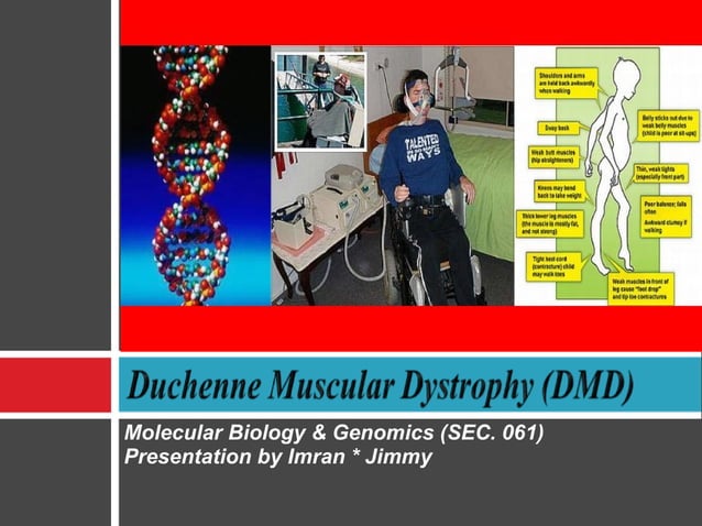 Duchenne Muscular Distrophy | PPT | Physical Therapy | Wellness