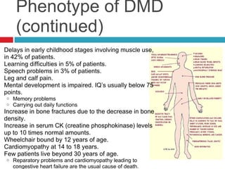 Duchenne Muscular Distrophy | PPT
