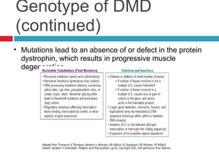 Duchenne Muscular Distrophy | PPT