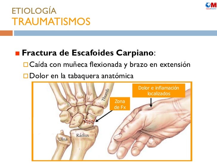El libro bubnovskogo sobre la osteocondrosis