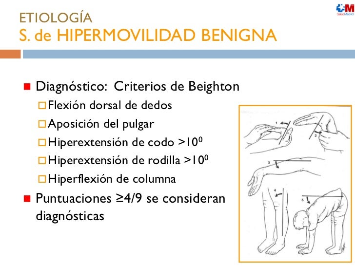El ejercicio para sheynogo del departamento de la columna vertebral en las estampas