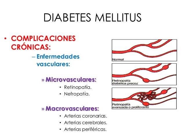 Diabetes Mellitus Diabetes Mellitus