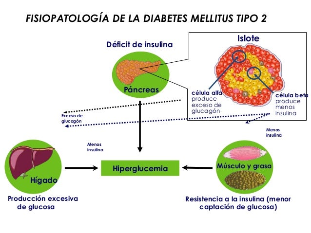 Diabetes Tipo 1 Fisiopatologia Diabetes Tipo 1 Fisiopatologia
