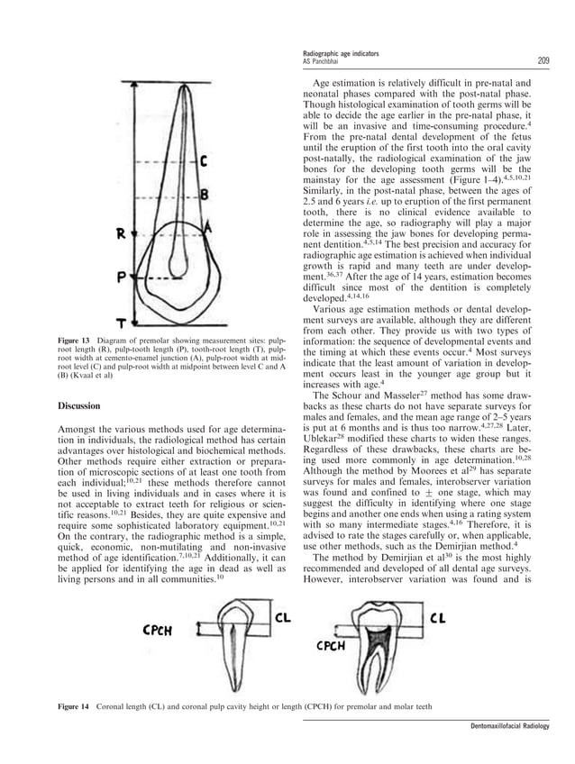 Dental radiographic indicators, a key to age estimation PDF