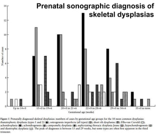 1
Prenatal sonographic diagnosis of
skeletal dysplasias
 