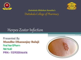 Herpes Zoster Infection
Presented By
Mundhe Dhananjay Balaji
FinalYearB.Pharm
RollNo.60
PRN:- 1131920046416
Dattakala Shikshan Sanstha’s
Dattakala College of Pharmacy
 