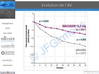 Evolution de l’AV Angiogénèse VEGF Anti-VEGF Aux XV-XX… Conclusion 