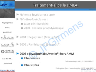 Traitement(s) de la DMLA NV extra-fovéolaires : laser NV rétro-fovéolaires : Laser péri-fovéolaire 2000 : Thérapie photodynamique 2004 : Pegaptanib (Macugen®) 2006 : Ranibizumab (Lucentis®) 2005 : Bevacizumab (Avastin®) hors AMM Intra-veineux Ophthalmology. 2005;112(6):1035-47.  Intra-vitréen Ophthalmic Surg Lasers Imaging. 2005;36(4):331-5 Angiogénèse VEGF Anti-VEGF Aux XV-XX… Conclusion 