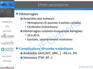 Effets secondaires Hémorragies Associées aux tumeurs Hémoptysies (K poumon à petites cellules) Cérébrales (métastases) Hémorragies cutanéo-muqueuses bénignes 20 à 40 % Epistaxis, spontanément résolutives Complications thrombo-emboliques Artérielles (AVC/AIT, IdM…) : 4% vs. 2%  Veineuses (TVP, EP…) Angiogénèse VEGF Anti-VEGF Aux XV-XX… Conclusion 
