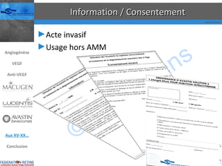 Information / Consentement Acte invasif Usage hors AMM Angiogénèse VEGF Anti-VEGF Aux XV-XX… Conclusion 