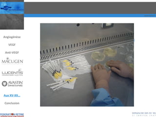 Angiogénèse VEGF Anti-VEGF Aux XV-XX… Conclusion 
