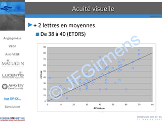 Acuité visuelle + 2 lettres en moyennes De 38 à 40 (ETDRS) © JFGirmens Angiogénèse VEGF Anti-VEGF Aux XV-XX… Conclusion 