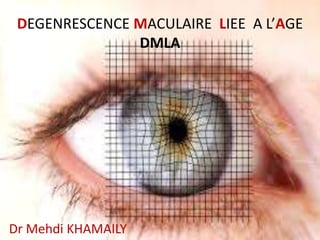 DEGENRESCENCE MACULAIRE LIEE A L’AGE
DMLA
Dr Mehdi KHAMAILY
 